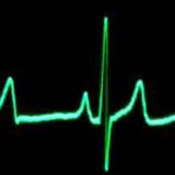 L’importanza dell’uso del cardiofrequenzimetro